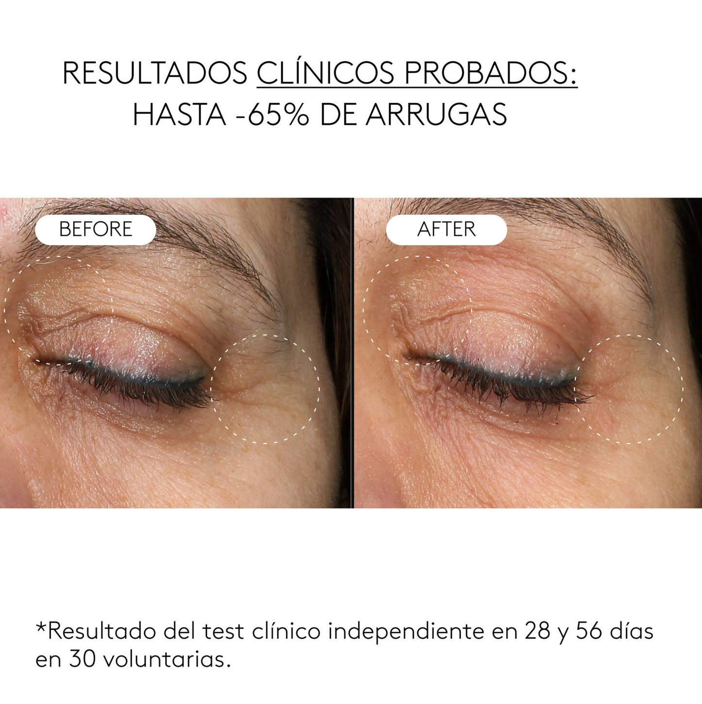 Clinical Exosomes: V-LIFTING EN 8 SEMANAS