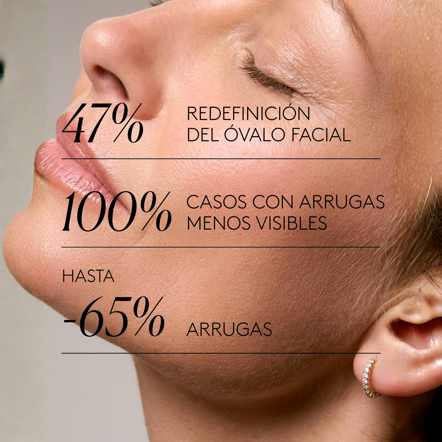 Clinical Exosomes: V-LIFTING EN 8 SEMANAS